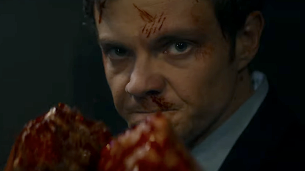 Bande-annonce de Novocaine : regardez Jack Quaid échanger les garçons contre un héros différent qui ne ressent pas la douleur